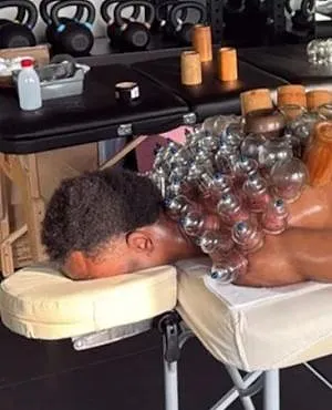Le « cupping », cette étrange méthode de récupération testée par Loïs Openda
