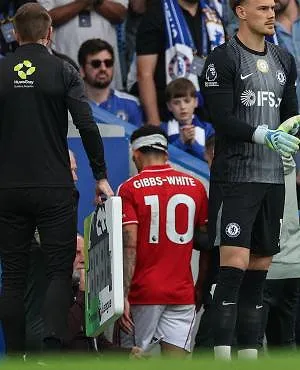 Des points de suture sur 10cm : les images impressionnantes du visage de Morgan Gibbs-White