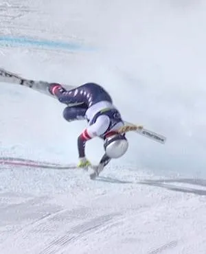 OS 2026: Vonn geopereerd om breuk te stabiliseren in linkerbeen na horrorcrash op Spelen - Belga