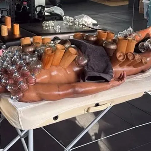 Le « cupping », cette étrange méthode de récupération testée par Loïs Openda