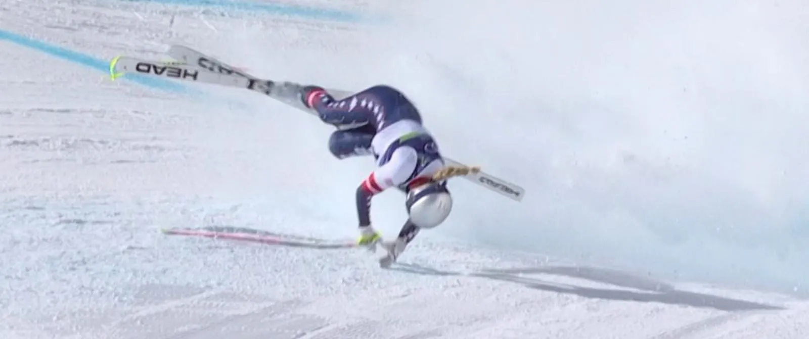 JO 2026 : le verdict est lourd pour Lindsey Vonn, opérée à la suite d’une fracture de la jambe gauche - Belga - Belga