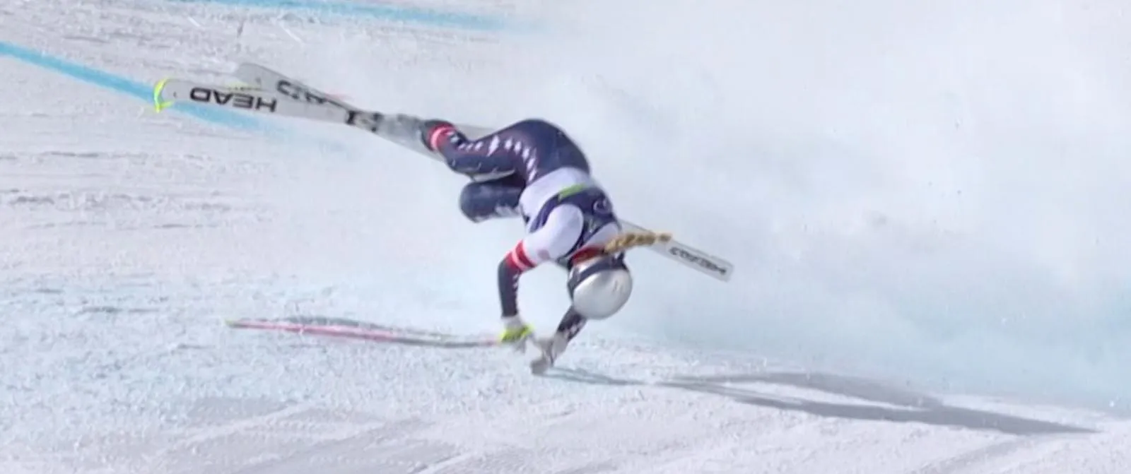 JO 2026 : Lindsey Vonn « n’a aucun regret » malgré sa fracture complexe du tibia gauche - Belga